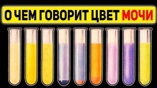 Что цвет мочи говорит о состоянии здоровья? Кровь в моче (гематурия)