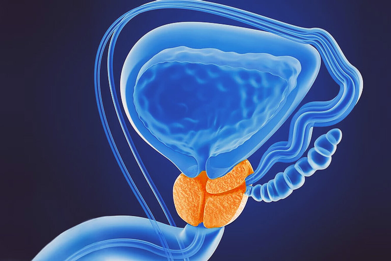 Простатит запах. Онкология предстательной железы. Предстательная железа 3d.