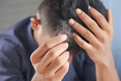 Когда надо беспокоиться из-за выпадения волос: дерматолог дала ответ