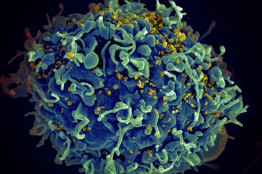 Найдено вещество, блокирующее распространение ВИЧ в теле