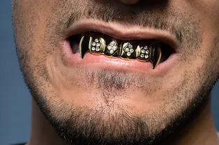 Вставить бриллианты и нарастить клыки: о чем пациенты просят стоматологов?