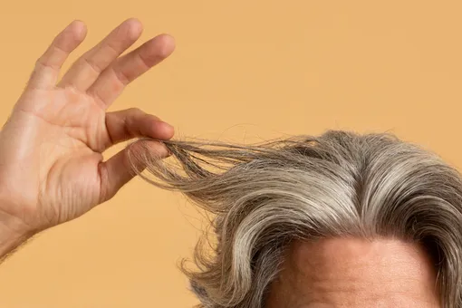 Снова шатен: в Нидерландах химиотерапия вернула цвет волос седому мужчине