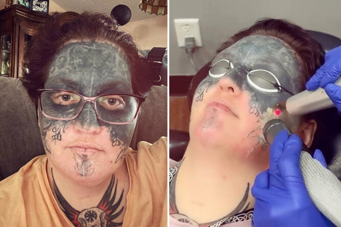 Против своей воли: девушка рассказала, как ей живется после того, как на ее лицо нанесли неприличные татуировки