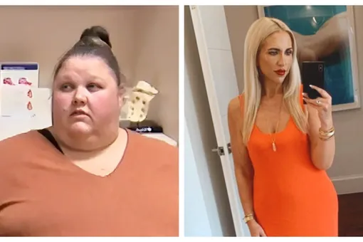 Женщина похудела на 95 кг: как выглядит ее кожа на самом деле
