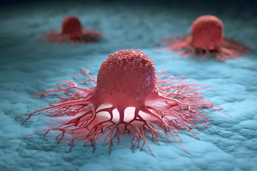 Как отличить раковые клетки от здоровых: 6 основных различий