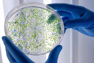 Тест на микробиом кишечника: нужно ли вам знать, кто у вас живет?
