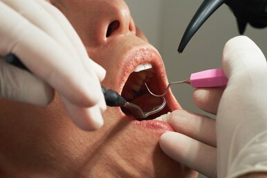 Можно ли водить автомобиль после того, как вам стоматолог лечил зубы с анестезией?