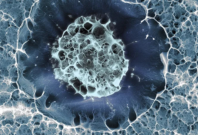 Стволовую клетку заморозили в матрице из гидрогеля, которая имитирует пространственную структуру костного мозга.S?LVIA A FERREIRA, CRISTINA LOPO, EILEEN GENTLEMAN