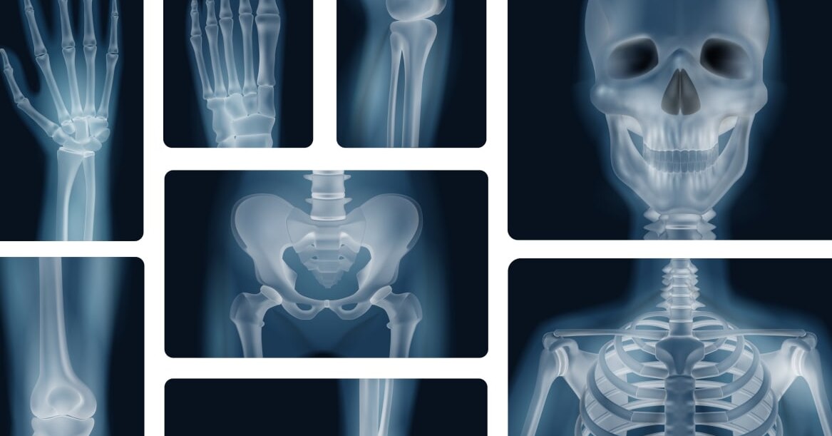 Сколько стоит почка человека?