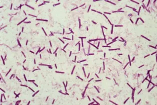 10 смертельно опасных бактерий, о существовании которых мы даже не подозреваем