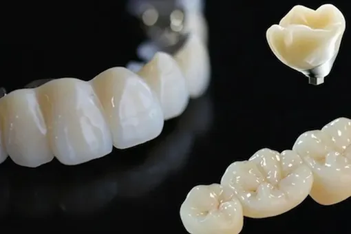Питерские студенты-технологи нашли способ удешевить производство зубных коронок