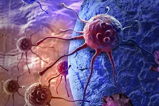 Как раковая опухоль появляется в организме человека