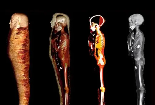 Сканирование дало возможность увидеть даже кости мумии, не вскрывая саркофаг