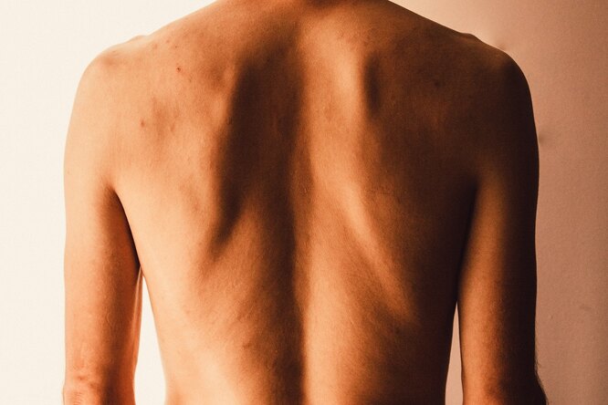 Привычки, разрушающие здоровье спины: как избежать боли и проблем со спиной