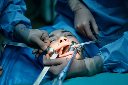 Кошмары челюстно-лицевой хирургии: три безнадежные истории, которые закончились хорошо