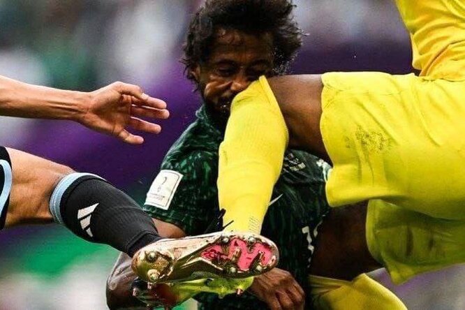 «Жуткая травма» на ЧМ-2022 оказалась фейком: разоблачающее видео от пострадавшего футболиста Саудовской Аравии
