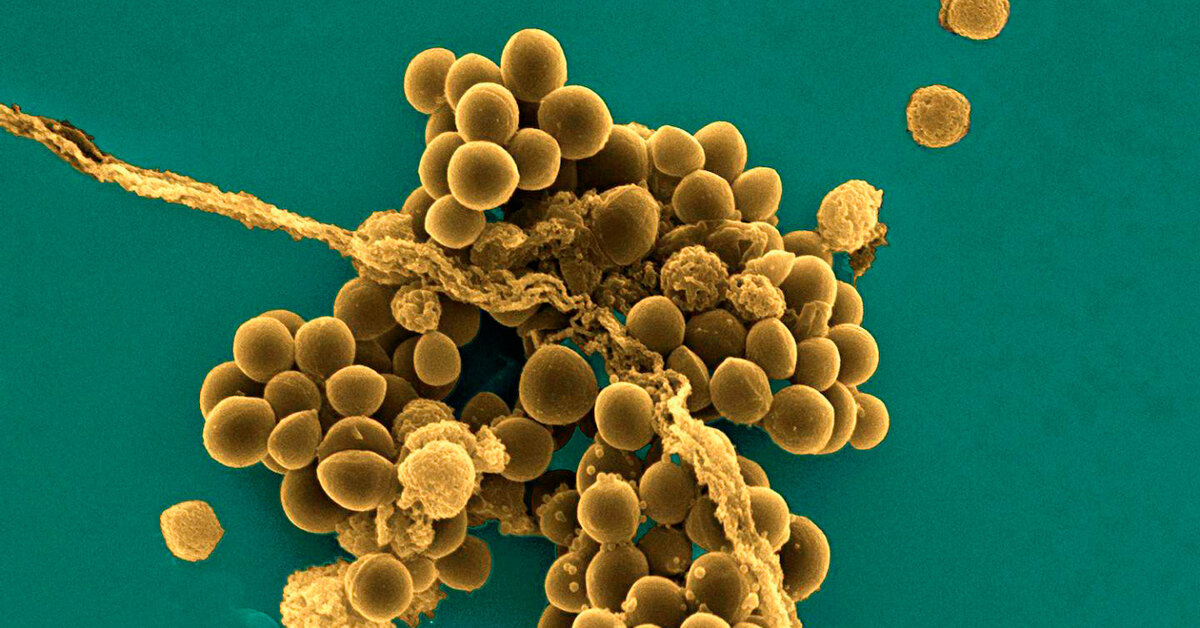 Врачи золотистый стафилококк. S. aureus золотистый стафилококк. Метициллин-резистентный золотистый стафилококк. Механизмы резистентности стафилококка ауреус. Золотистый стафилококк под микроскопом.