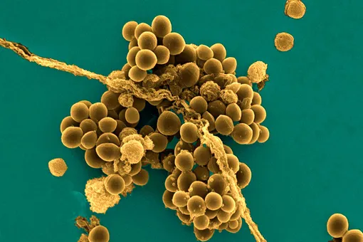 Устойчивый к антибиотикам штамм золотистого стафилококка не связан с эволюцией медицины