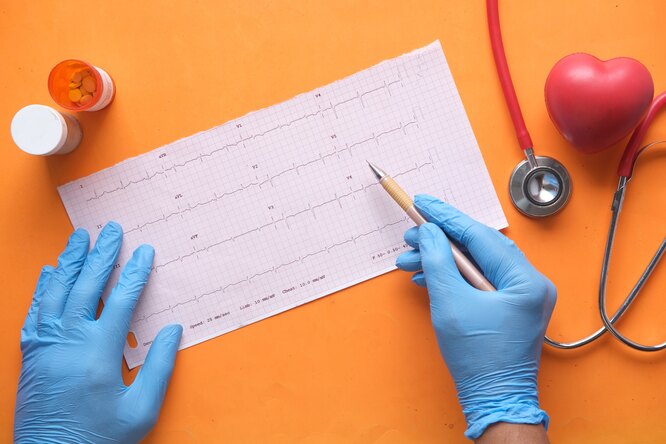 Как распознать приближающийся инсульт: простой тест, который покажет, в каком состоянии ваше сердце