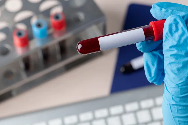 Анализ крови может выявить 19 видов рака за семь лет до появления симптомов