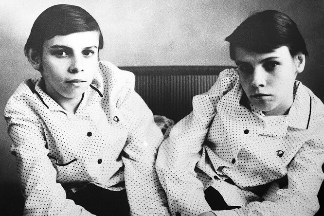 Трагедия первых сиамских близнецов в СССР: на них ставили опыты и довели до алкоголизма — узнайте, как плохо они кончили