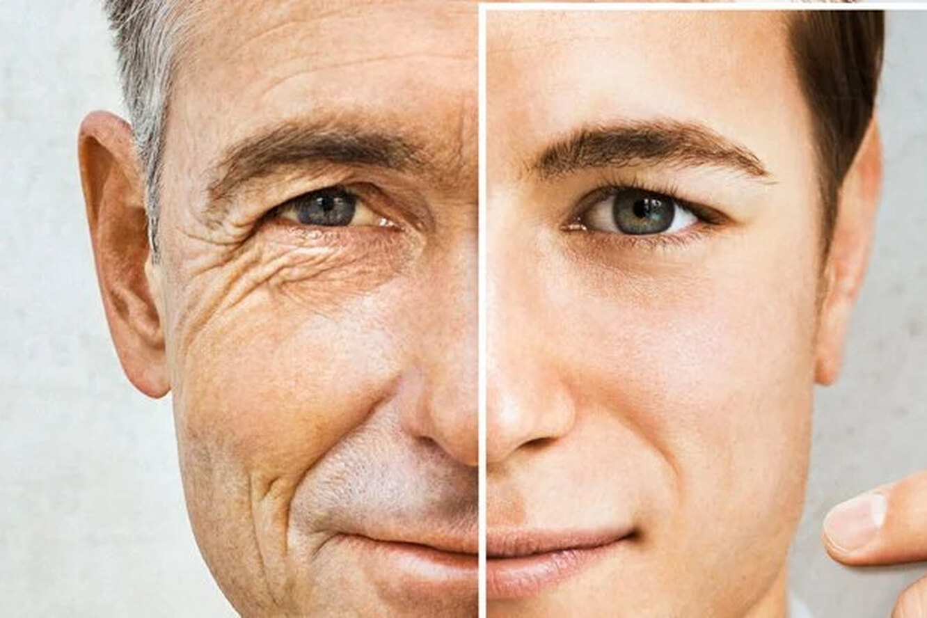 Старение человека. Замедлить старение. Замедление старения кожи. Стареющая кожа. Наука о старости удаление молочной