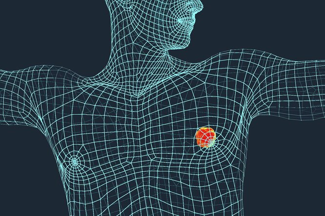 Рак груди у мужчин: как его вовремя распознать?