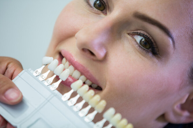 Отбеливание зубов: как делается и вредно ли оно