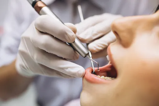 Стоматолог без разрешения пациента вылечил ему все зубы. Теперь он должен выплатить гигантскую компенсацию