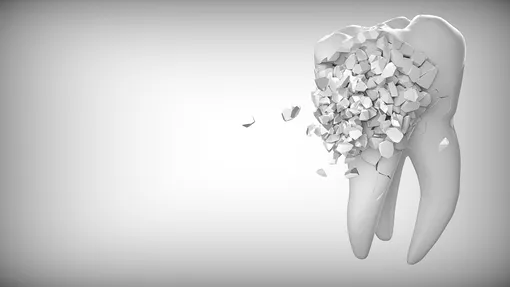 Как восстановить зубную эмаль? Без помощи стоматолога организму не справиться, ведь регенерация зубов в этом случае почти бесполезна. Организм человека при обнажении внутренней зубной пульпы воспроизводит полоску дентина — зубной ткани. Этот слой размещается под эмалью зуба, но большие поврежденные участки регенерацией не закрыть.