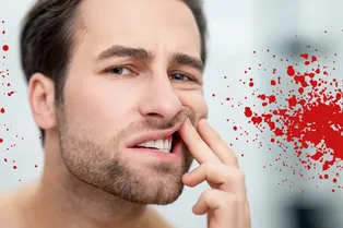 Почему кровоточат десны и когда пора идти к стоматологу