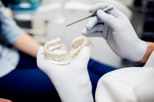 Из-за отсутствия некоторых зубов лицо пожилых людей может «обвисать». С установкой имплантов решается и эта проблема.