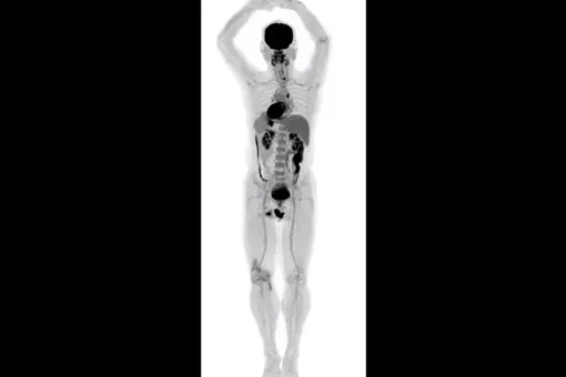Удивительные снимки, сделанные первым в мире сканером для тела