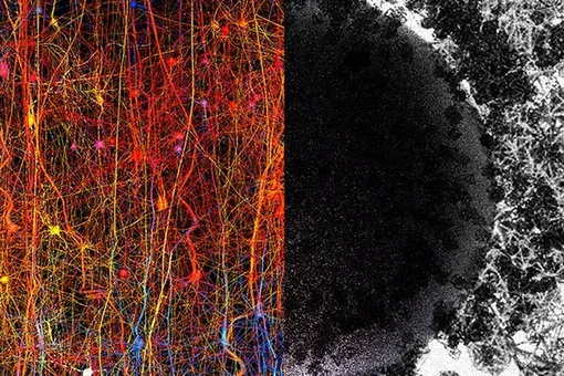 11 измерений: невероятная сложность человеческого мозга