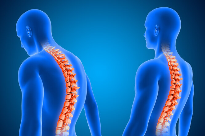 Как исправить осанку: правила и упражнения для ровной спины