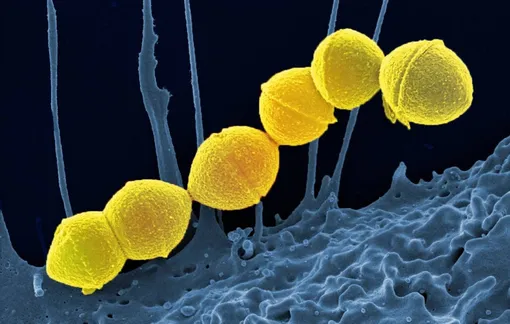 Бактерии стрептококка группы А под микроскопом