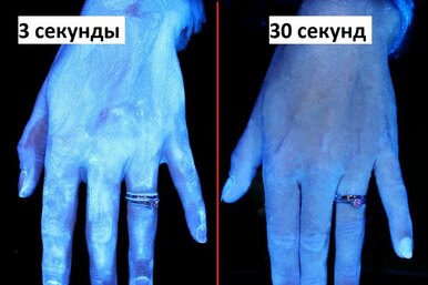 Как выглядят руки после мытья под ультрафиолетом
